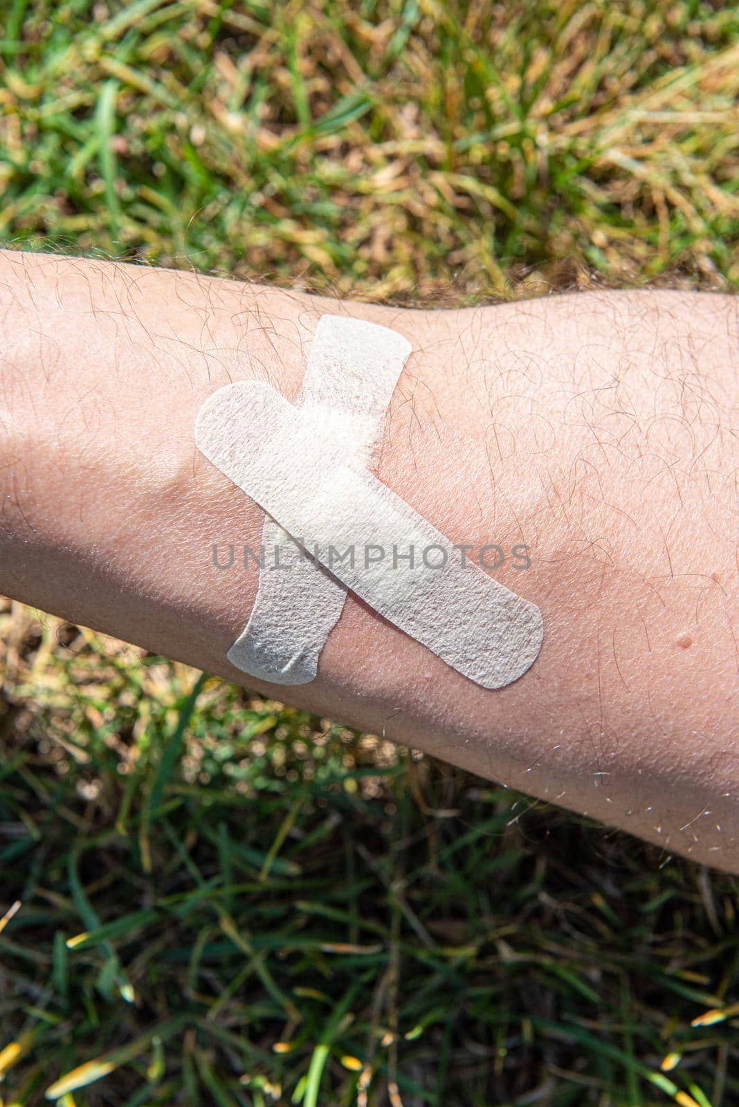 male shin wound sealed by adhesive plaster close up.