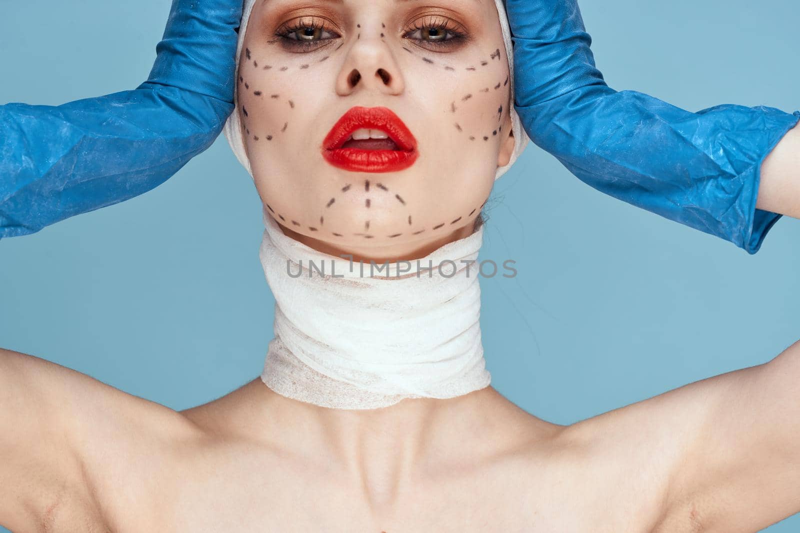 female patient Red lips plastic surgery operation bare shoulders blue background by Vichizh