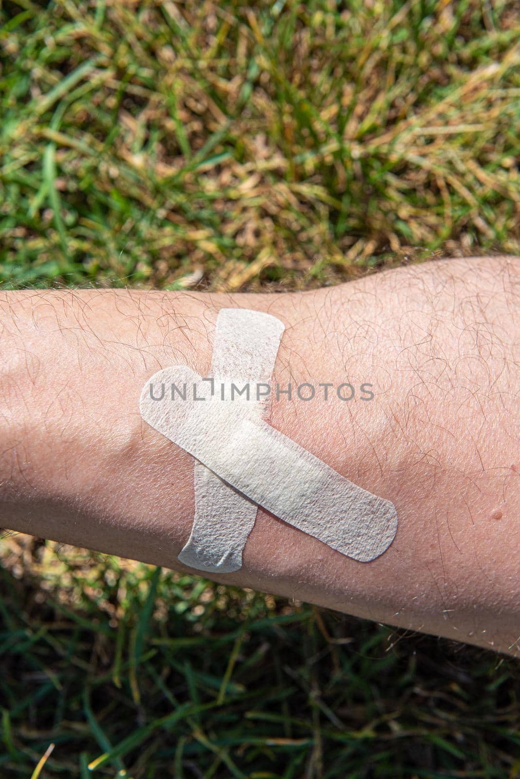 male shin wound sealed by adhesive plaster close up.