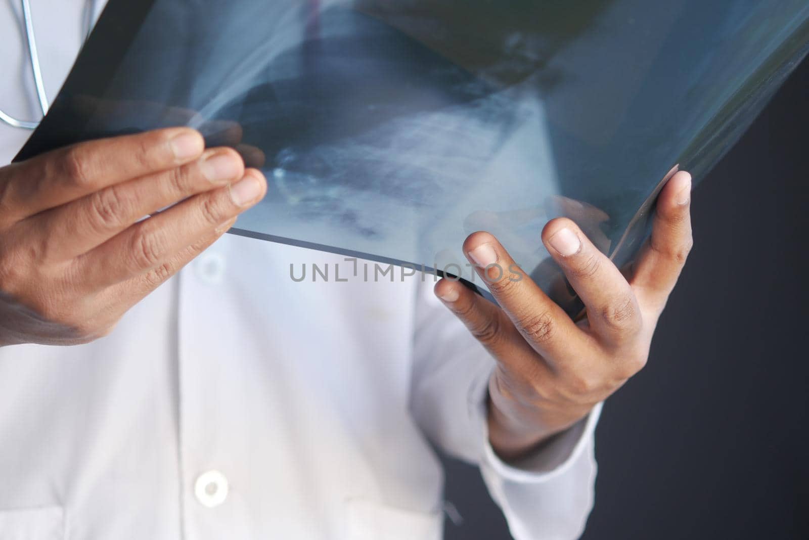 doctor hold analyzing xray photography closeup