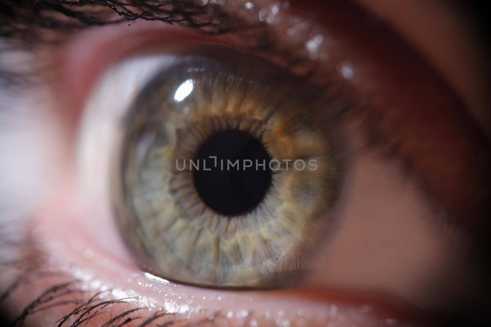 Female gray green pupil with eyelashes. Laser vision correction concept