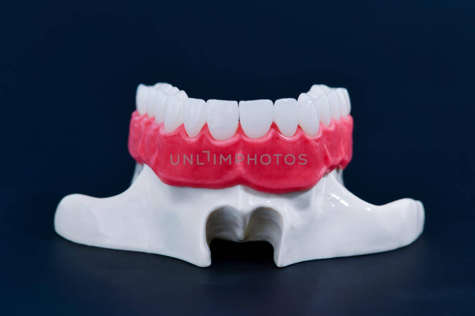 Upper human jaw with teeth and gums anatomy model medical illustration isolated on blue background. Healthy teeth, dental care and orthodontic concept