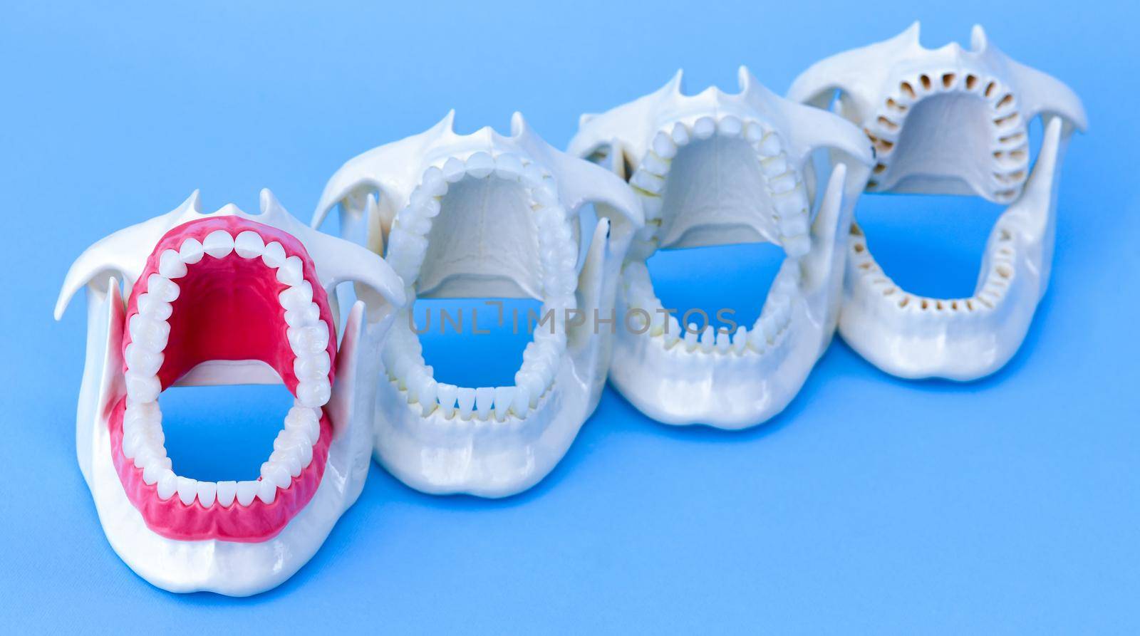 Dentist orthodontic teeth models with jaws opened on blue background
