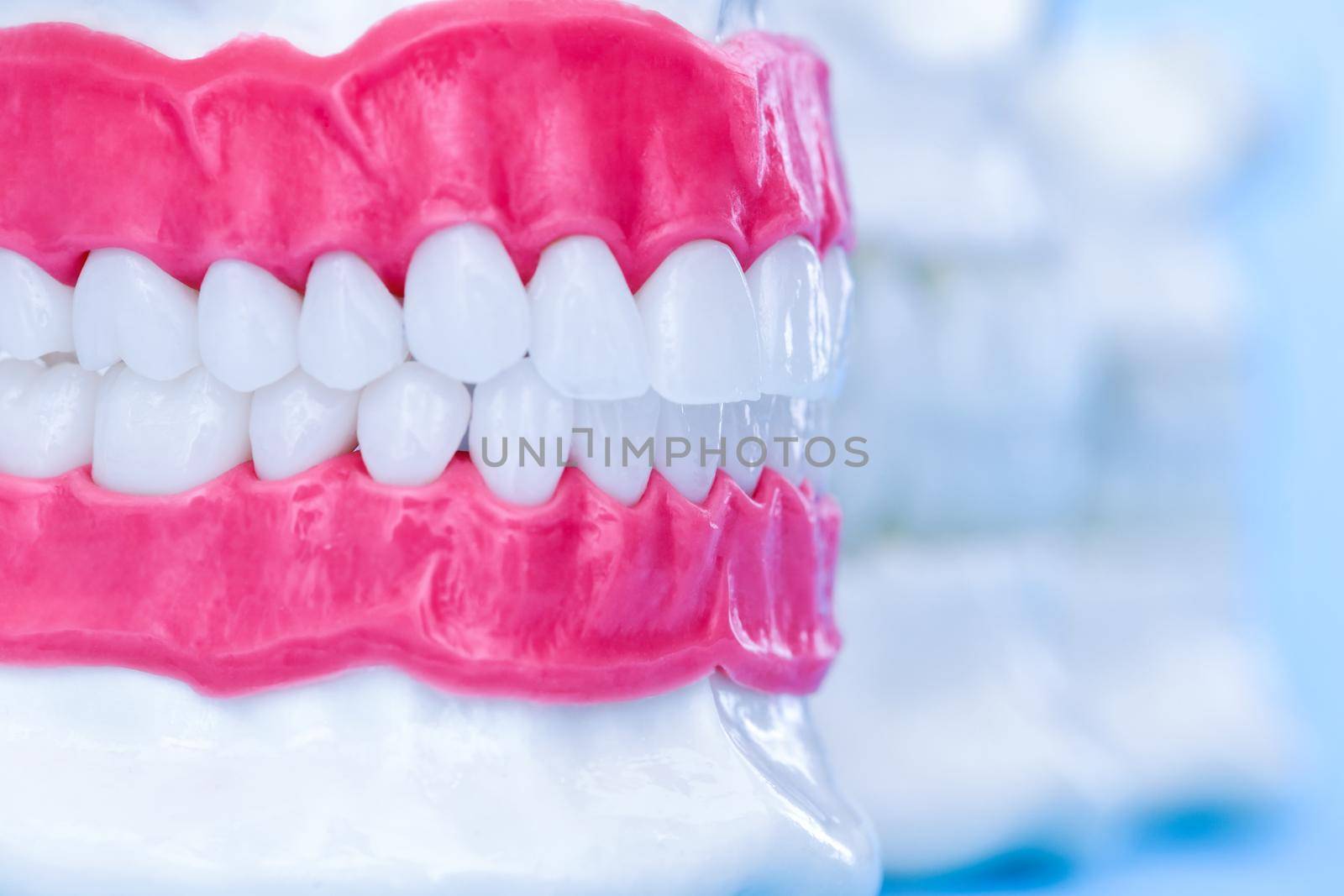 Human jaws with teeth and gums anatomy models medical illustration isolated on blue background. Healthy teeth, dental care and orthodontic concept