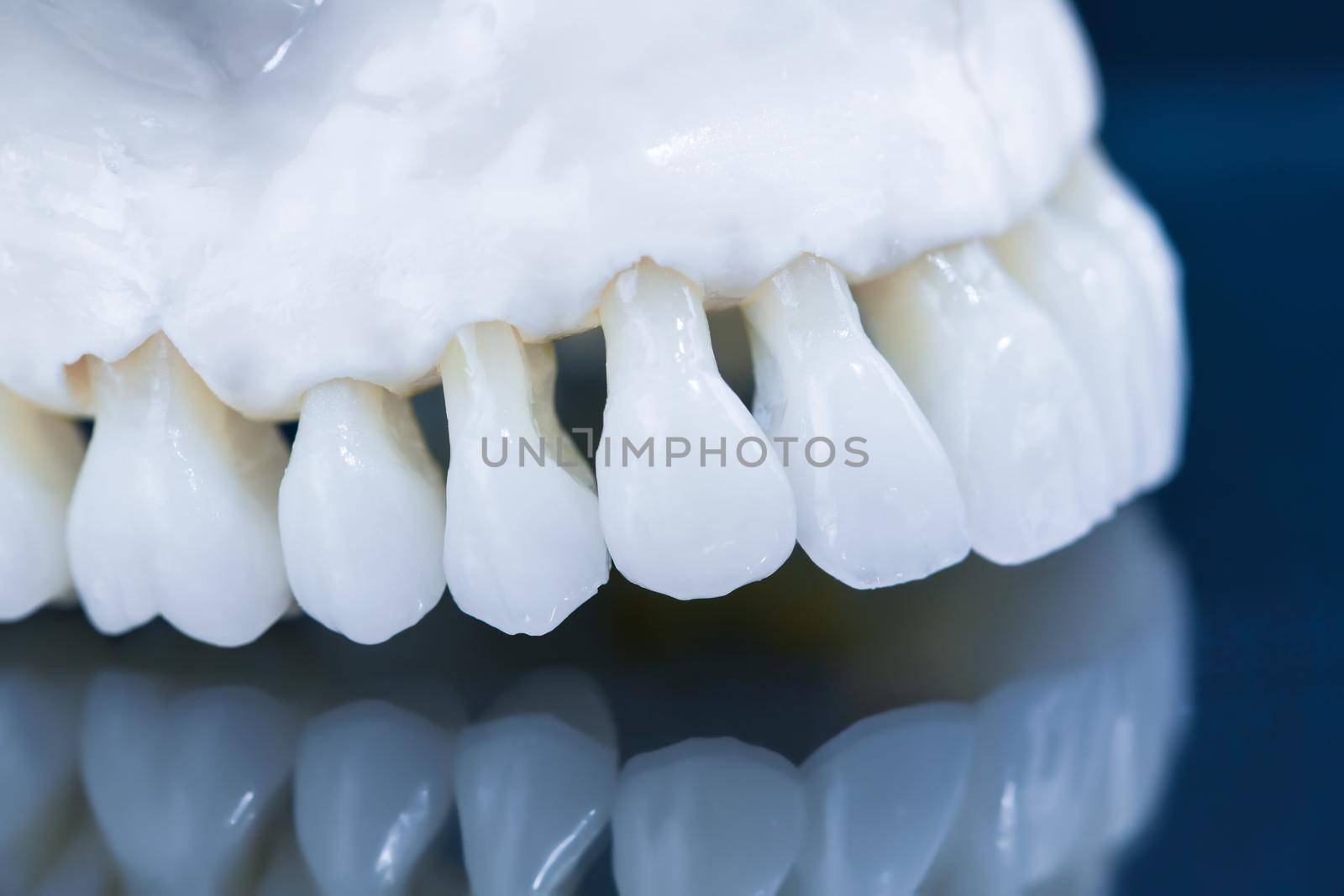 Upper human jaw with a reflection on the glass anatomy model medical illustration isolated on blue background. Healthy teeth, dental care and orthodontic concept