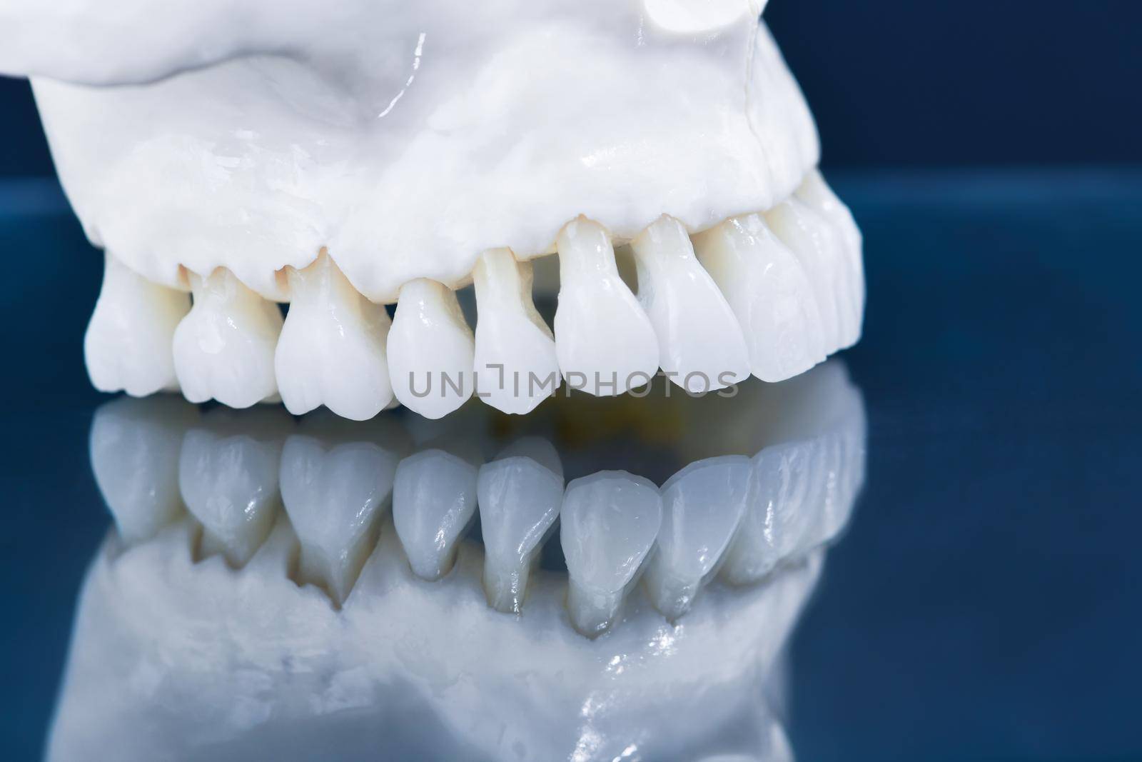 Upper human jaw with a reflection on the glass anatomy model medical illustration isolated on blue background. Healthy teeth, dental care and orthodontic concept