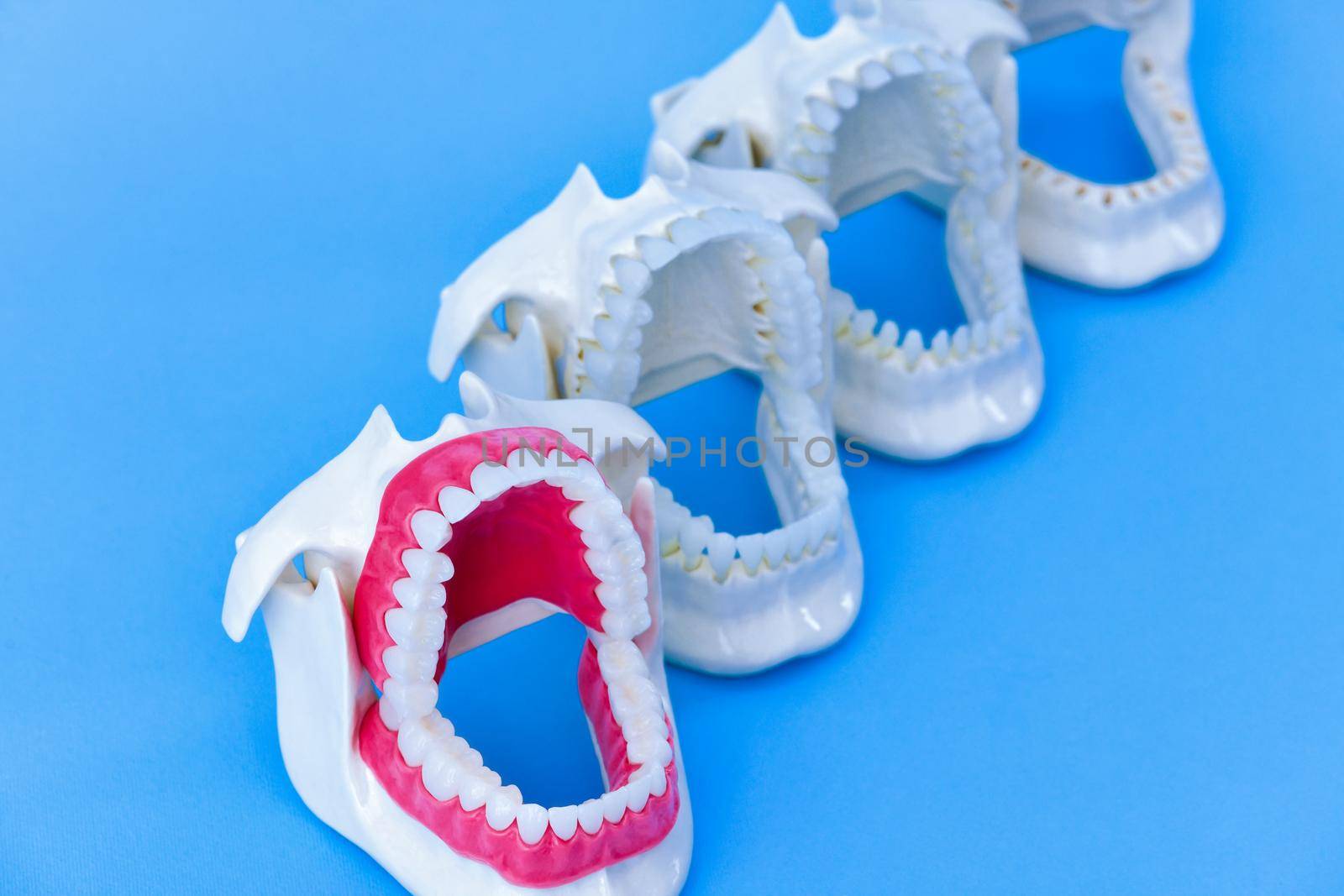 Dentist orthodontic teeth models by dotshock