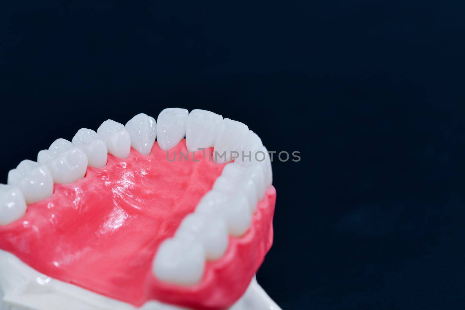 Upper human jaw with teeth and gums anatomy model by dotshock