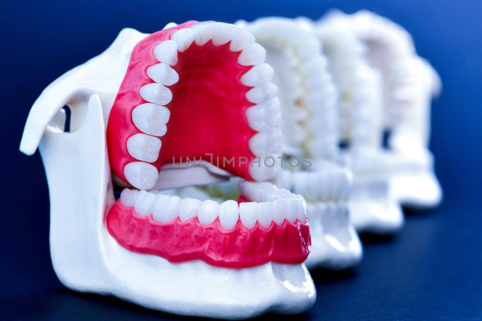 Dentist orthodontic teeth models by dotshock