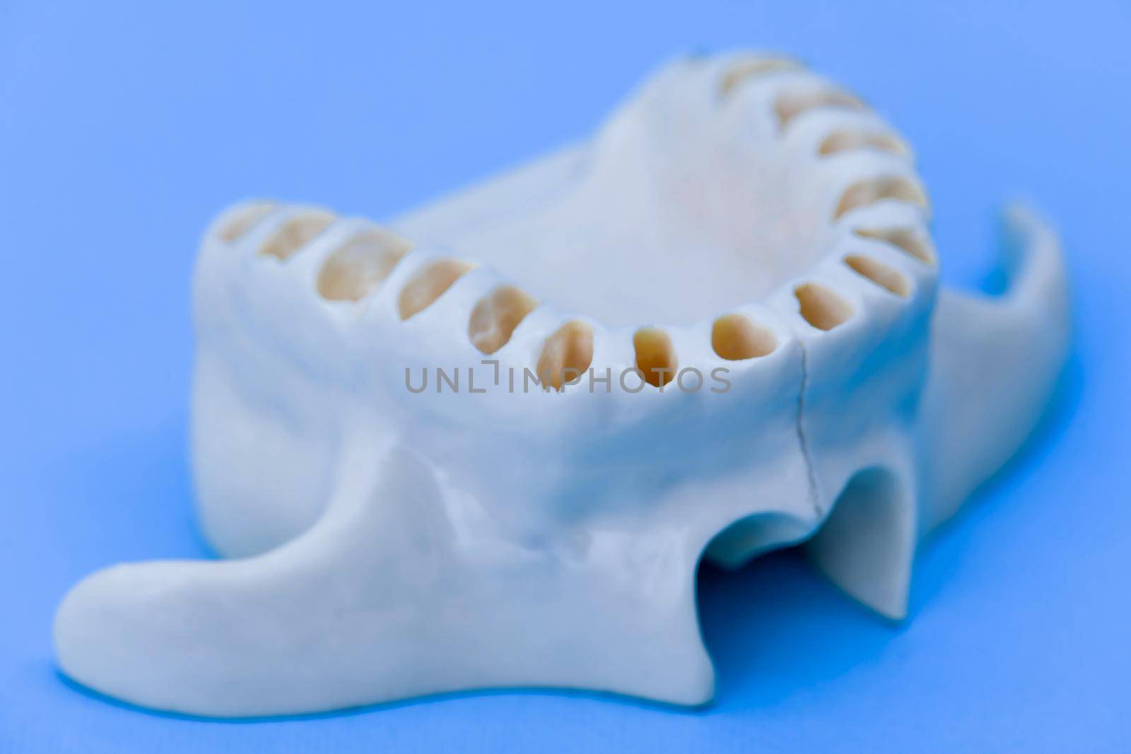 Upper human jaw without teeth model medical illustration isolated on blue background. Healthy teeth, dental care and orthodontic concept