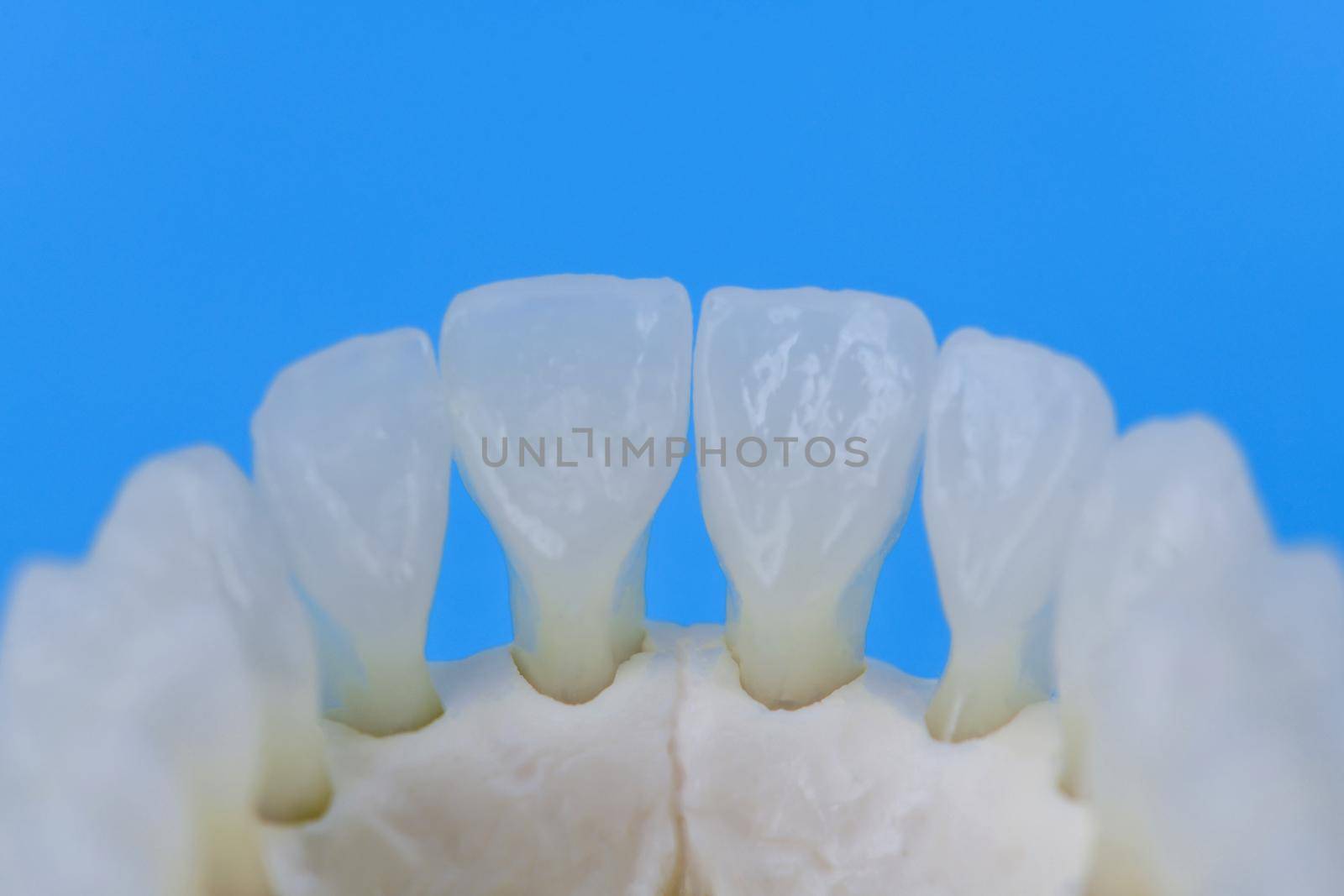 Lower human jaw with teeth anatomy model medical illustration isolated on blue background. Healthy teeth, dental care and orthodontic concept