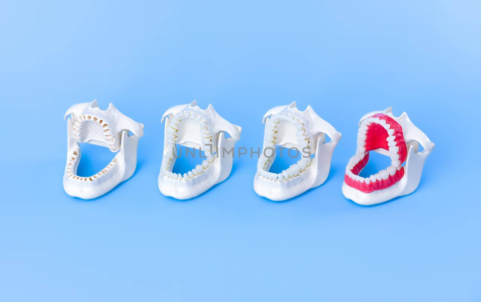 Dentist orthodontic teeth models by dotshock
