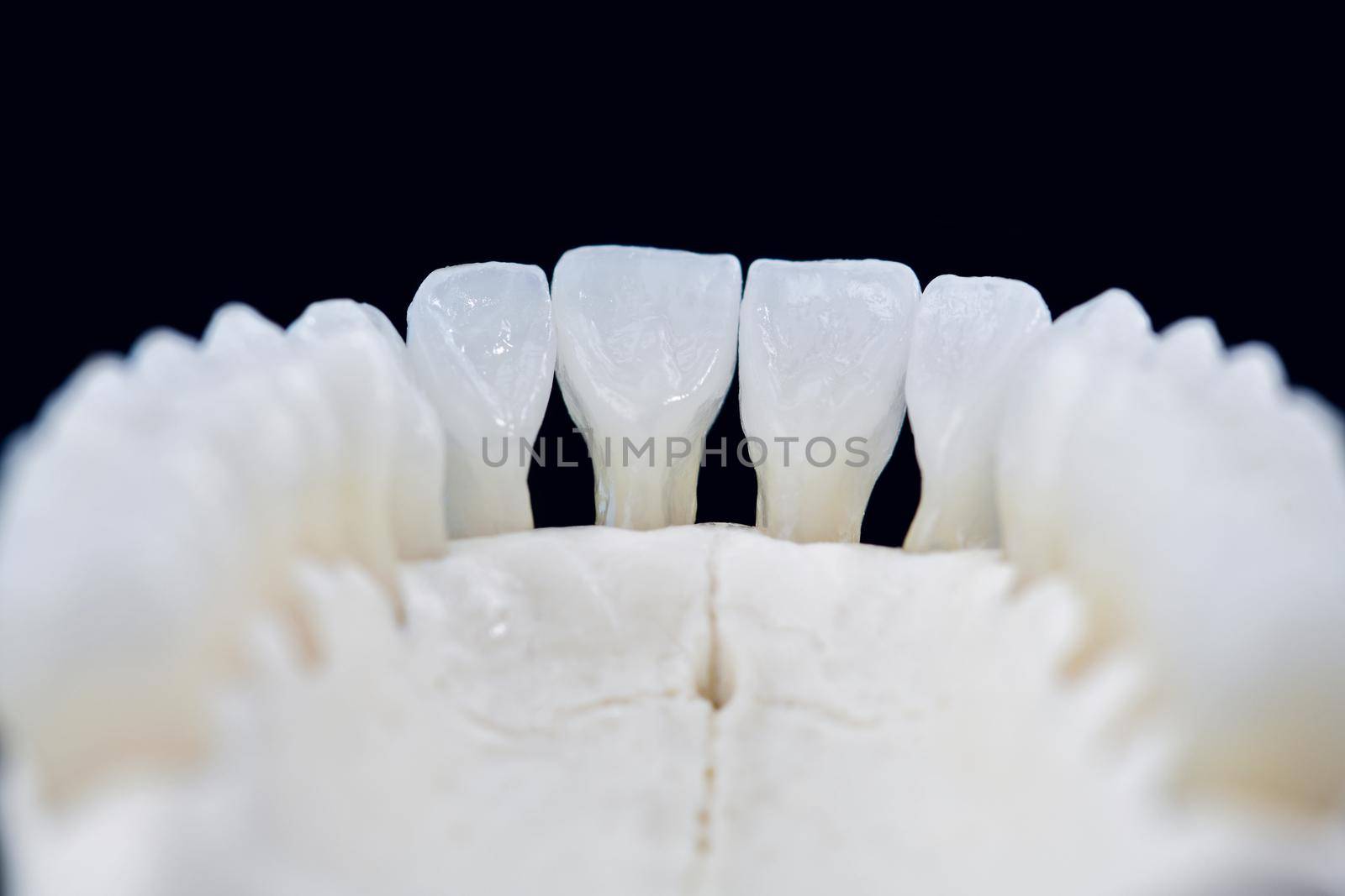 Lower human jaw with teeth anatomy model medical illustration isolated on black background. Healthy teeth, dental care and orthodontic concept