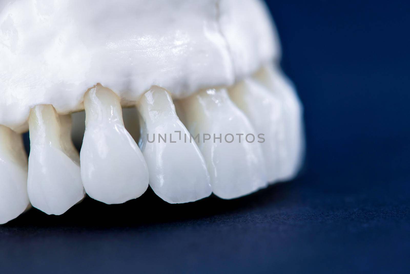 Upper human jaw with teeth by dotshock