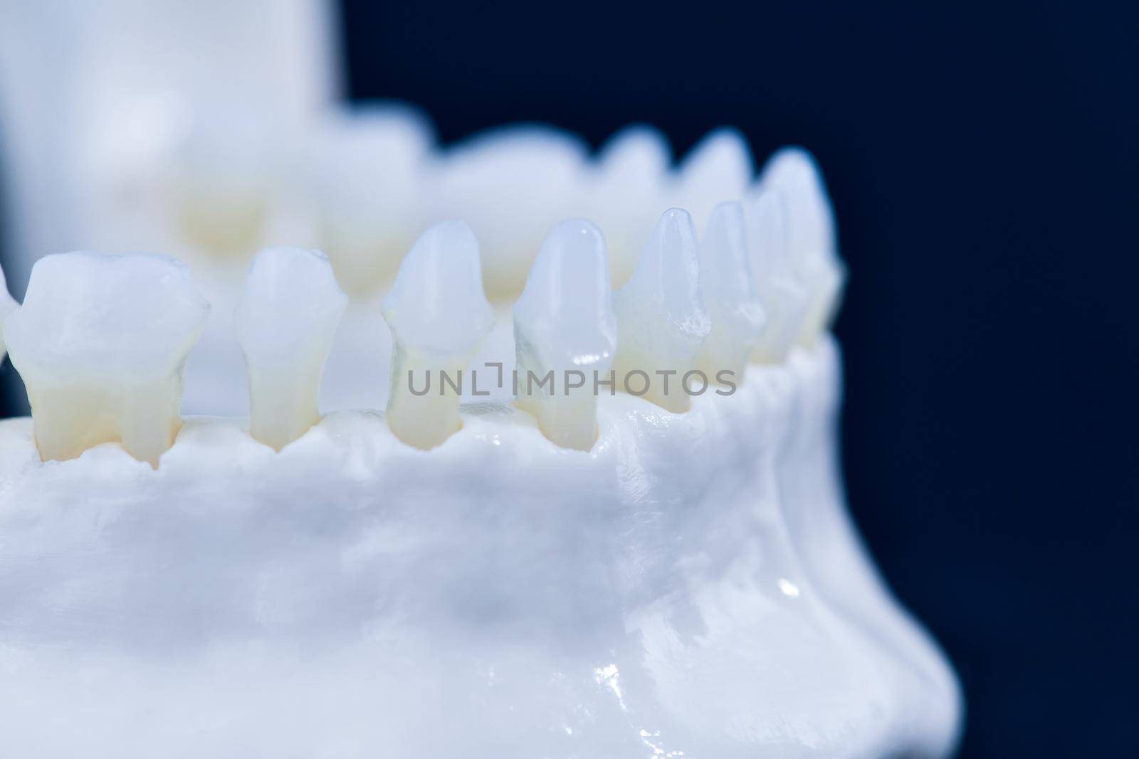 Lower human jaw with teeth anatomy model medical illustration isolated on blue background. Healthy teeth, dental care and orthodontic concept