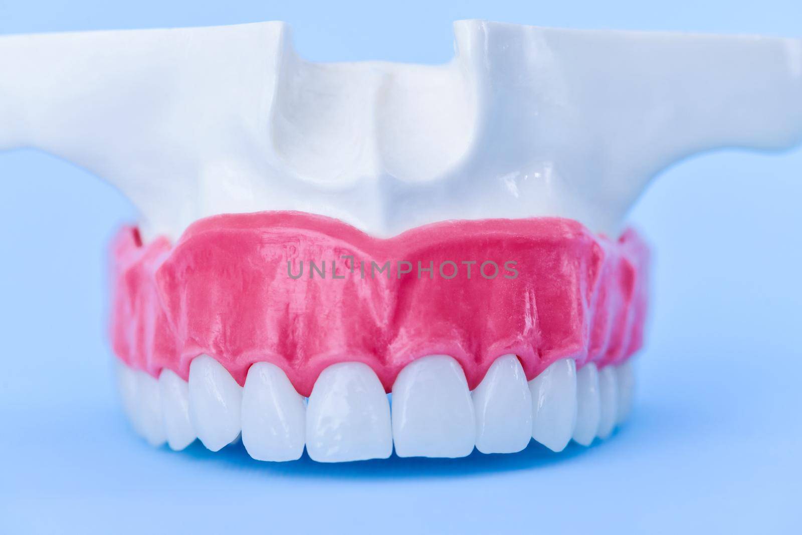 Upper human jaw with teeth and gums anatomy model medical illustration isolated on blue background. Healthy teeth, dental care and orthodontic concept