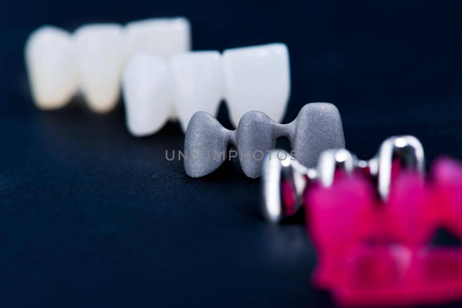 different types of dental tooth crowns isolated on blue background