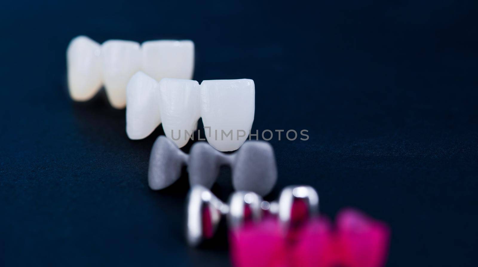 different types of dental tooth crowns isolated on blue background