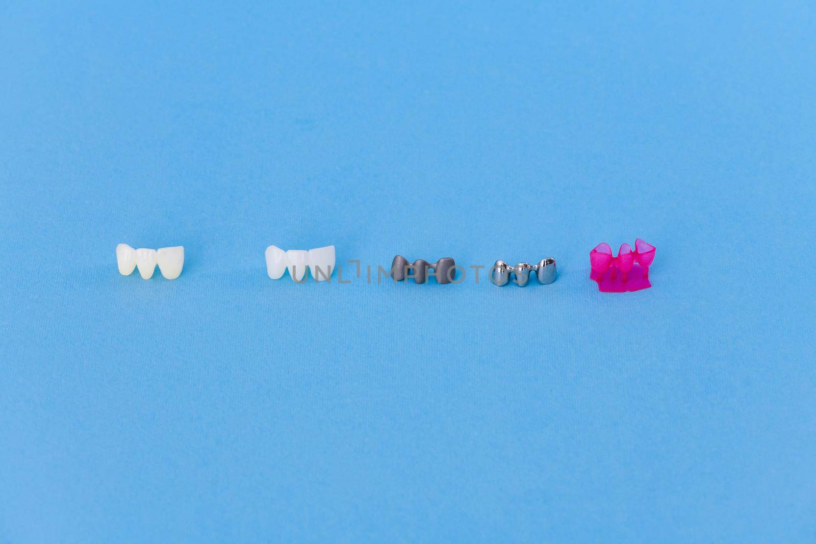 different types of dental tooth crowns isolated on blue background