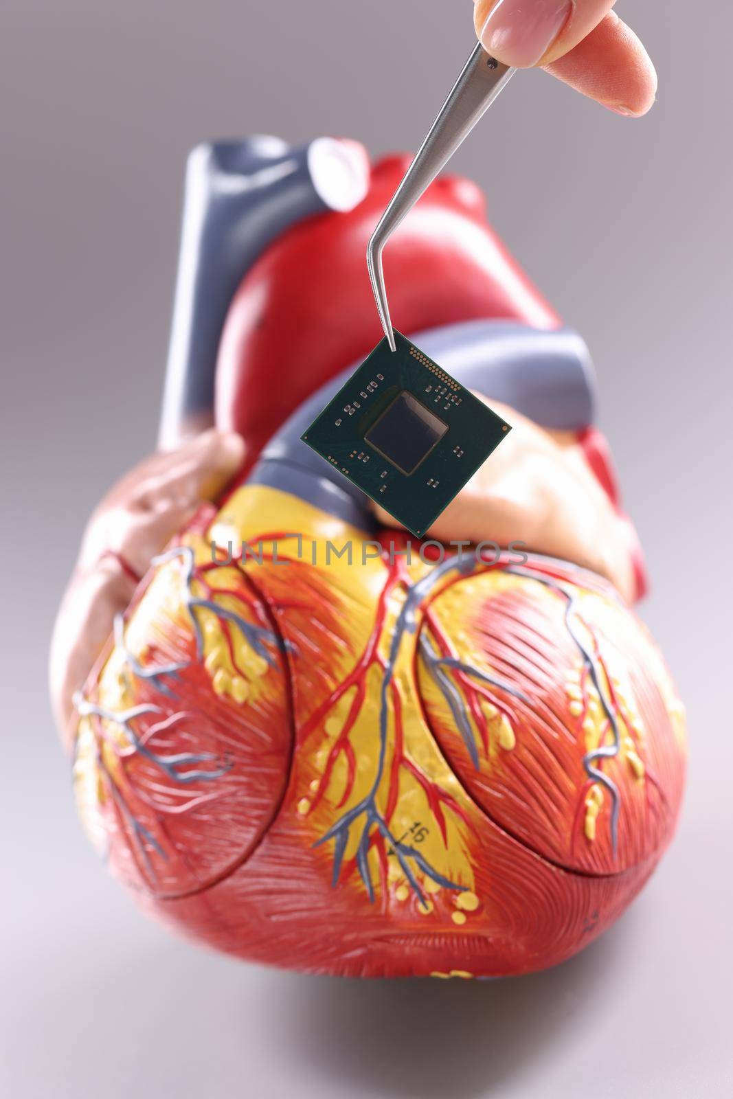 Model of heart with cardiac pacemaker in form of chip. Installation and implantation of a pacemaker concept