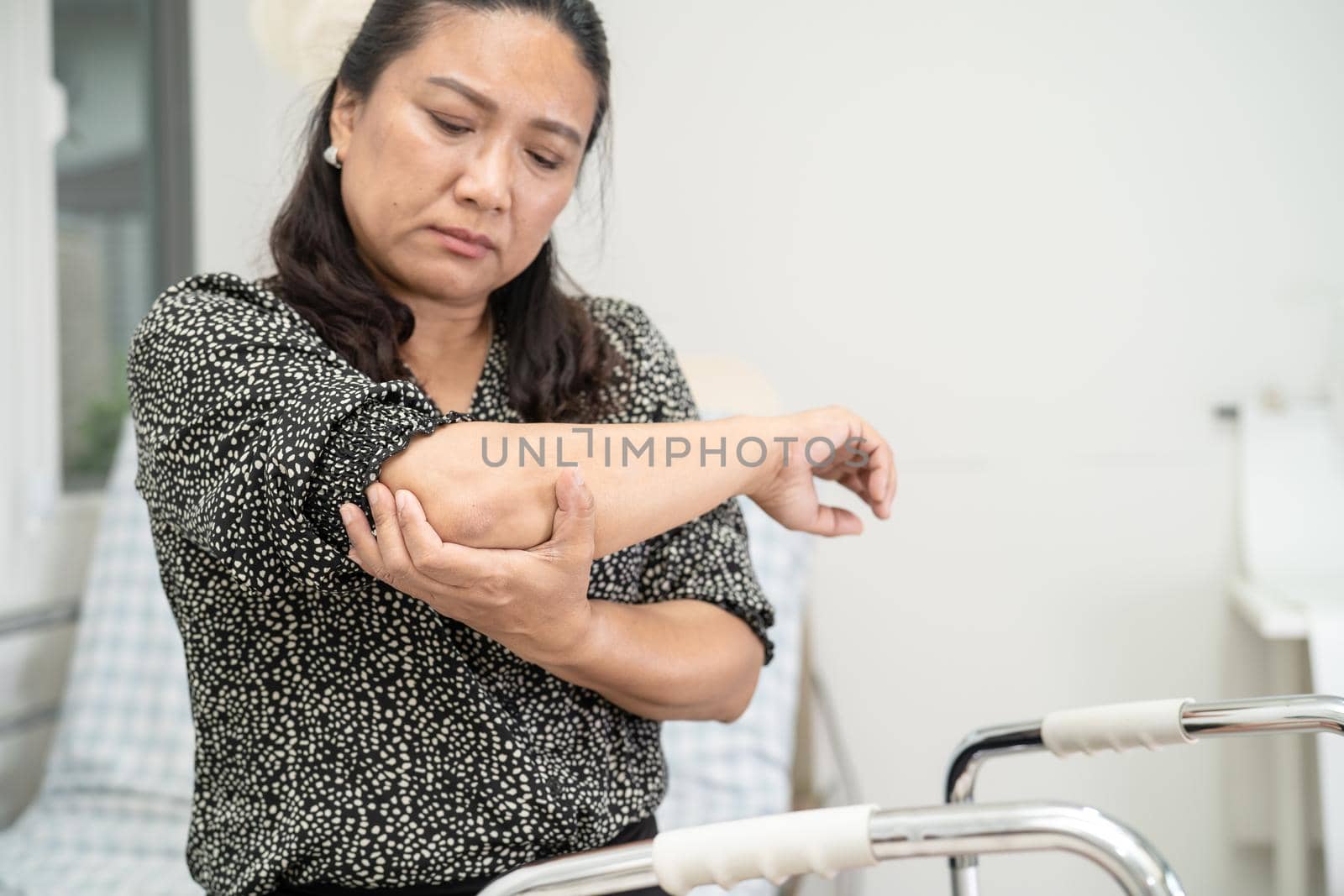 Asian middle-aged lady woman patient touch and feel pain her elbow and arm, healthy medical concept.