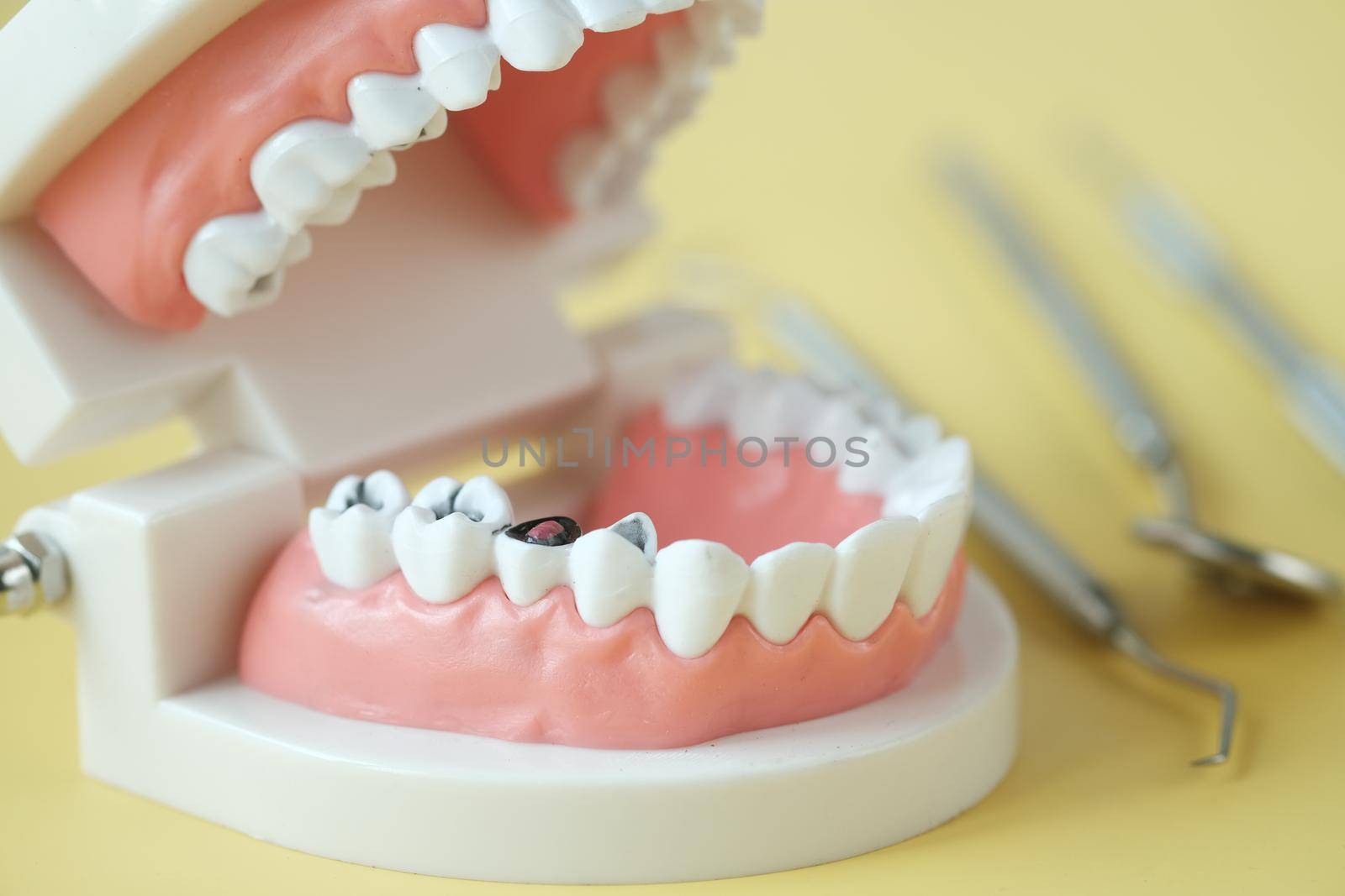 plastic dental teeth model on white background .