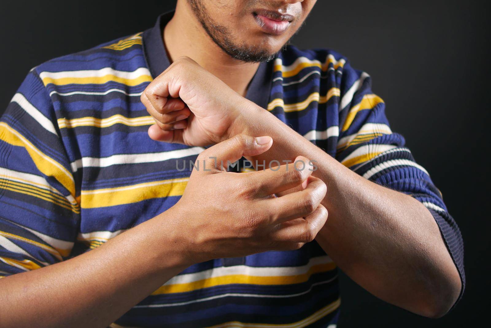 man suffering from itching skin, close up