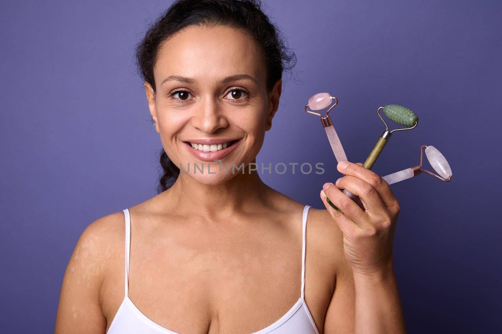 Beauty portrait of an African American pretty woman with vitiligo skin problems, in white underwear smiles with a beautiful toothy smile holding colorful facial roller massagers near her face. by artgf