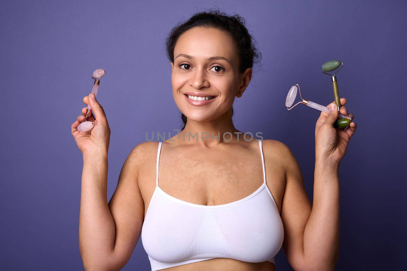 Delightful pretty woman with vitiligo skin problems smiles with beautiful toothy smile holding roller massagers near her face, confidently looking at camera posing on violet background. Copy space by artgf