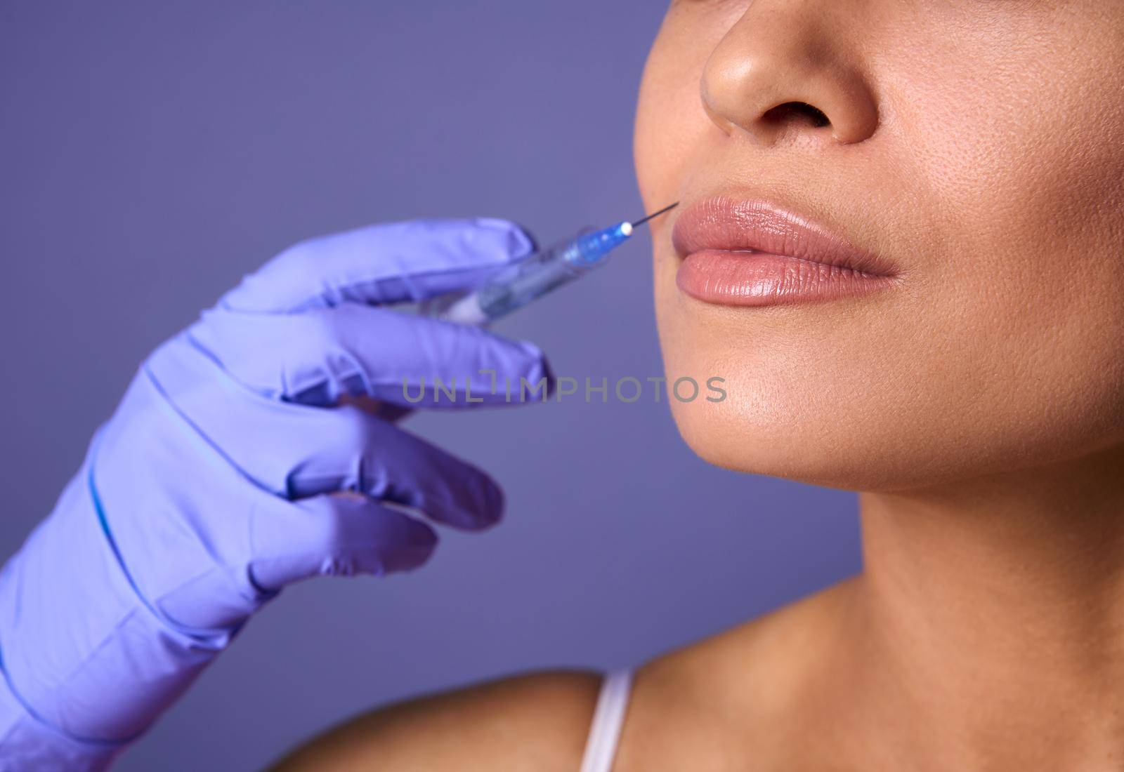 Close-up of woman face and hand in surgical glove holding syringe near her lips, ready to receive beauty treatment. Injection cosmetology, aesthetic surgery, lips augmentation and correction concept.