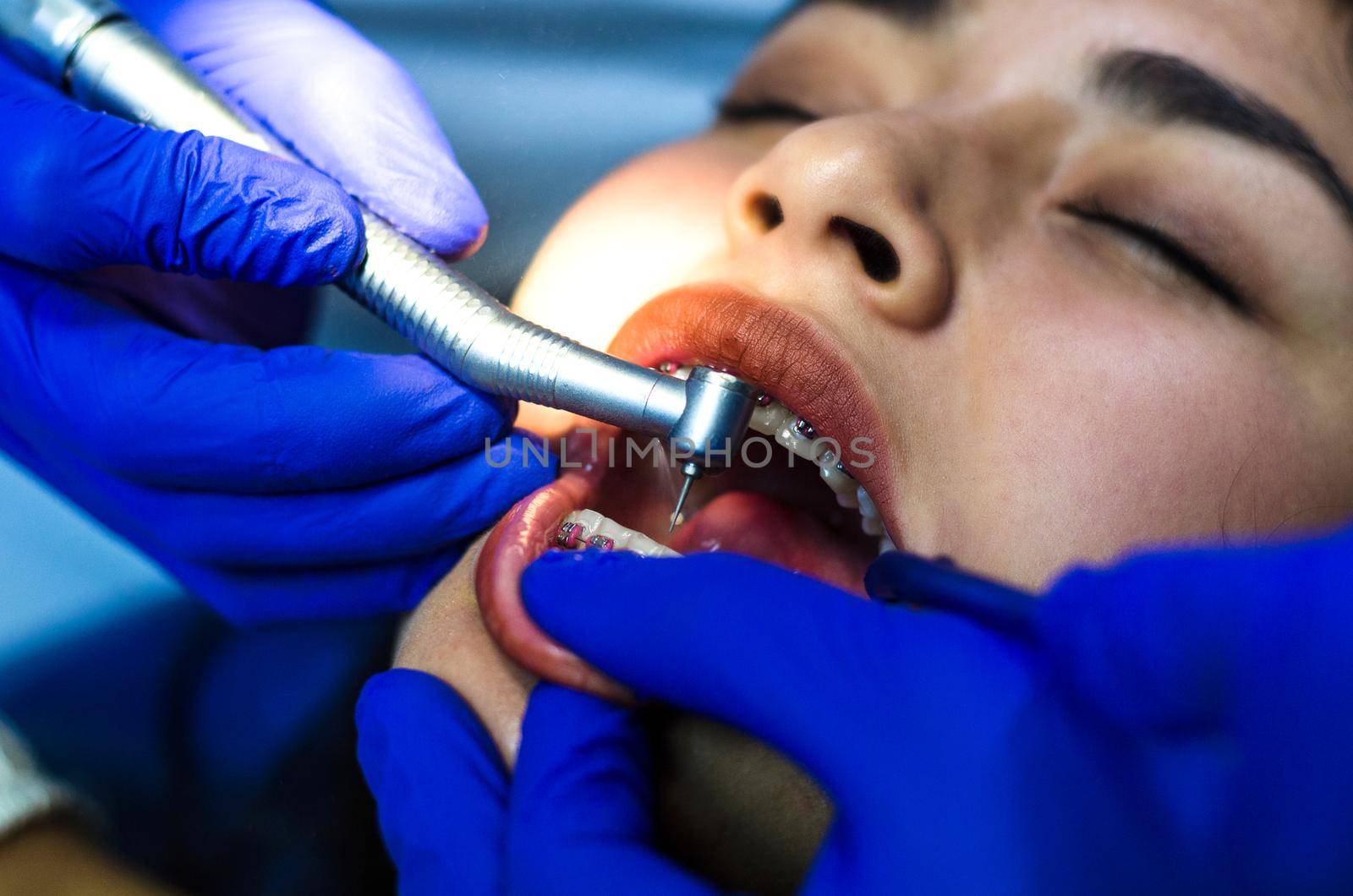 Female patient at dental procedure using dental drill in modern dental clinic
