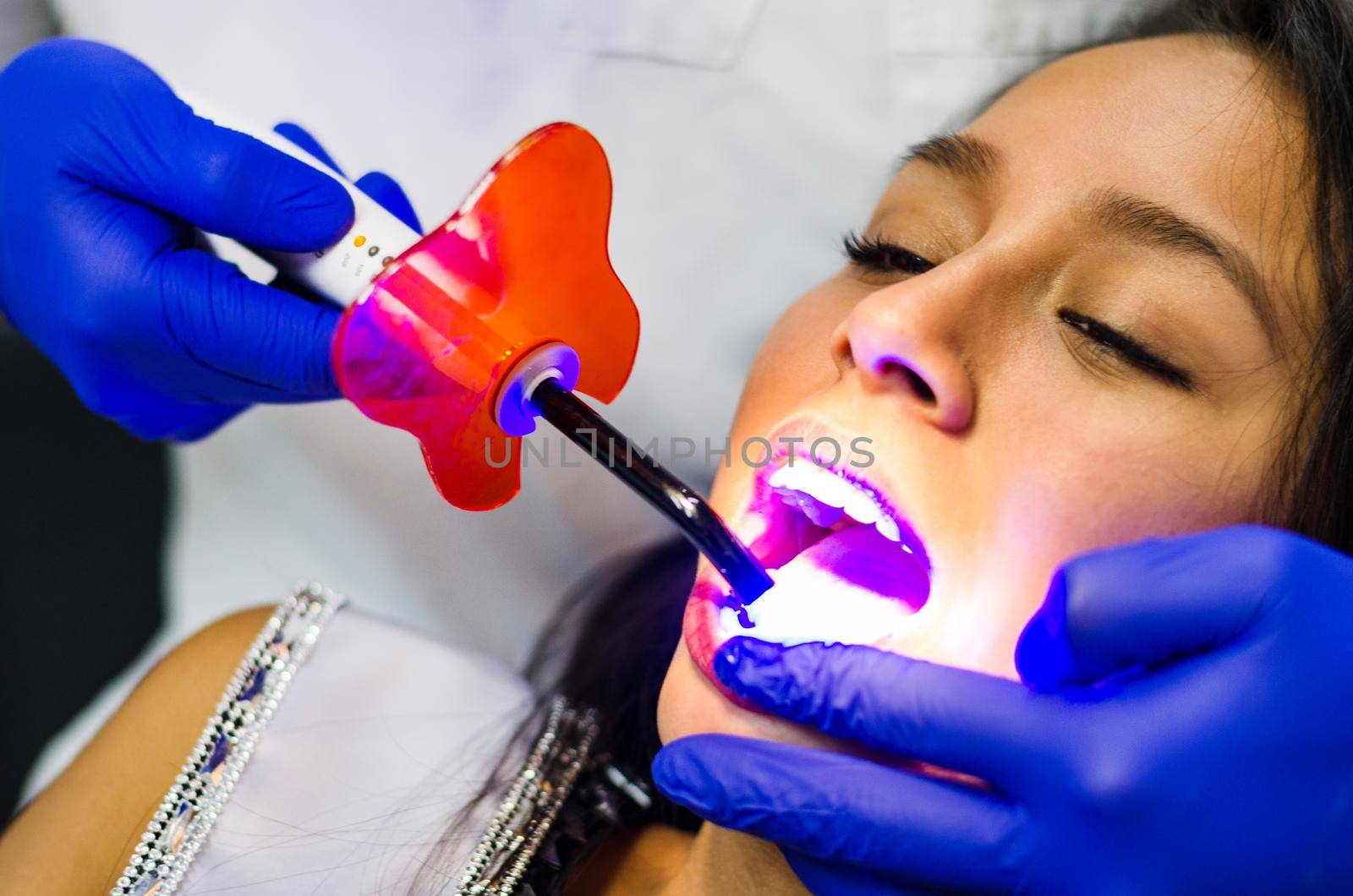 Close-up portrait of a female patient visiting dentist for teeth whitening by Peruphotoart