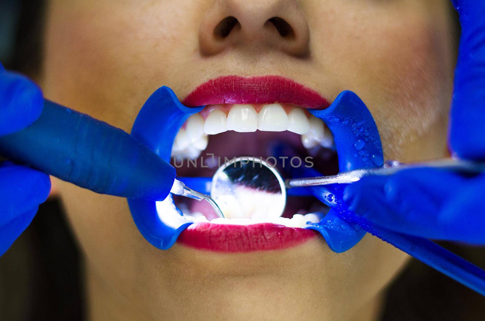 Periodic comprehensive dental examination to have a healthy teeth by Peruphotoart