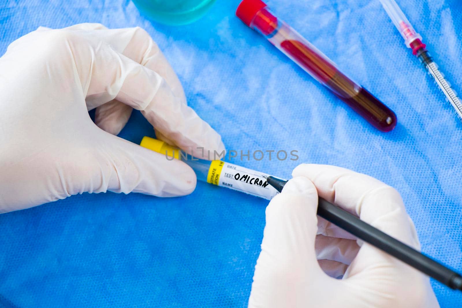 Omicron blood test. Doctor in laboratory with uniform write text on the blood tube sample, white glove