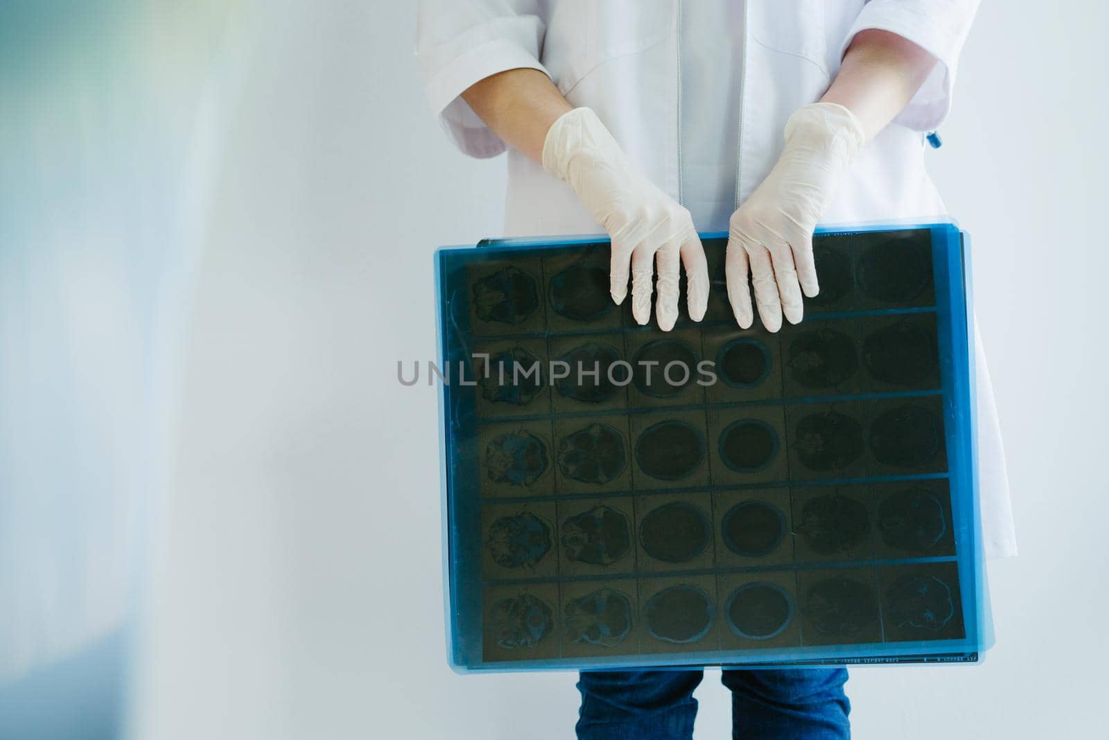 The girl doctor's is holding X-ray examinations in her hands. The doctor's hands are gloved.