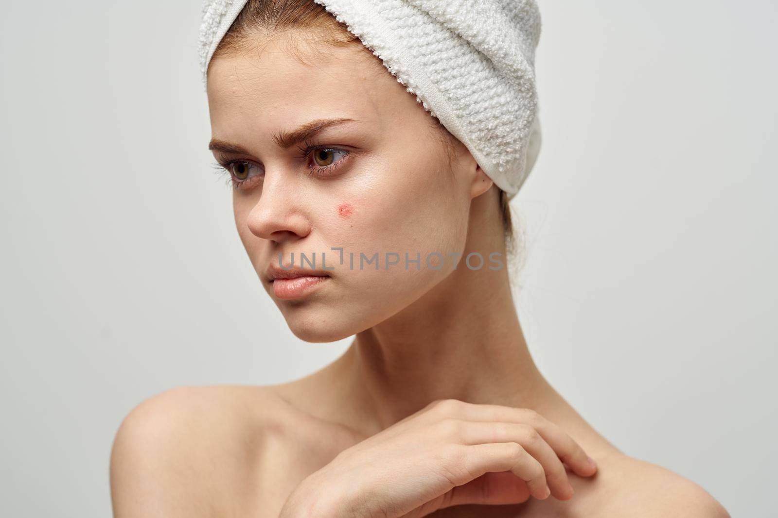 beautiful woman with a towel on my head dermatology isolated background. High quality photo