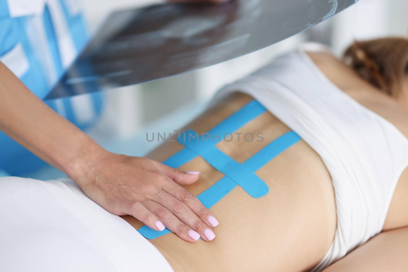 Close-up of woman doctor hold scan of woman back and correct kinesiology tape on females body. Treatment for faster recovery after injury. Health concept