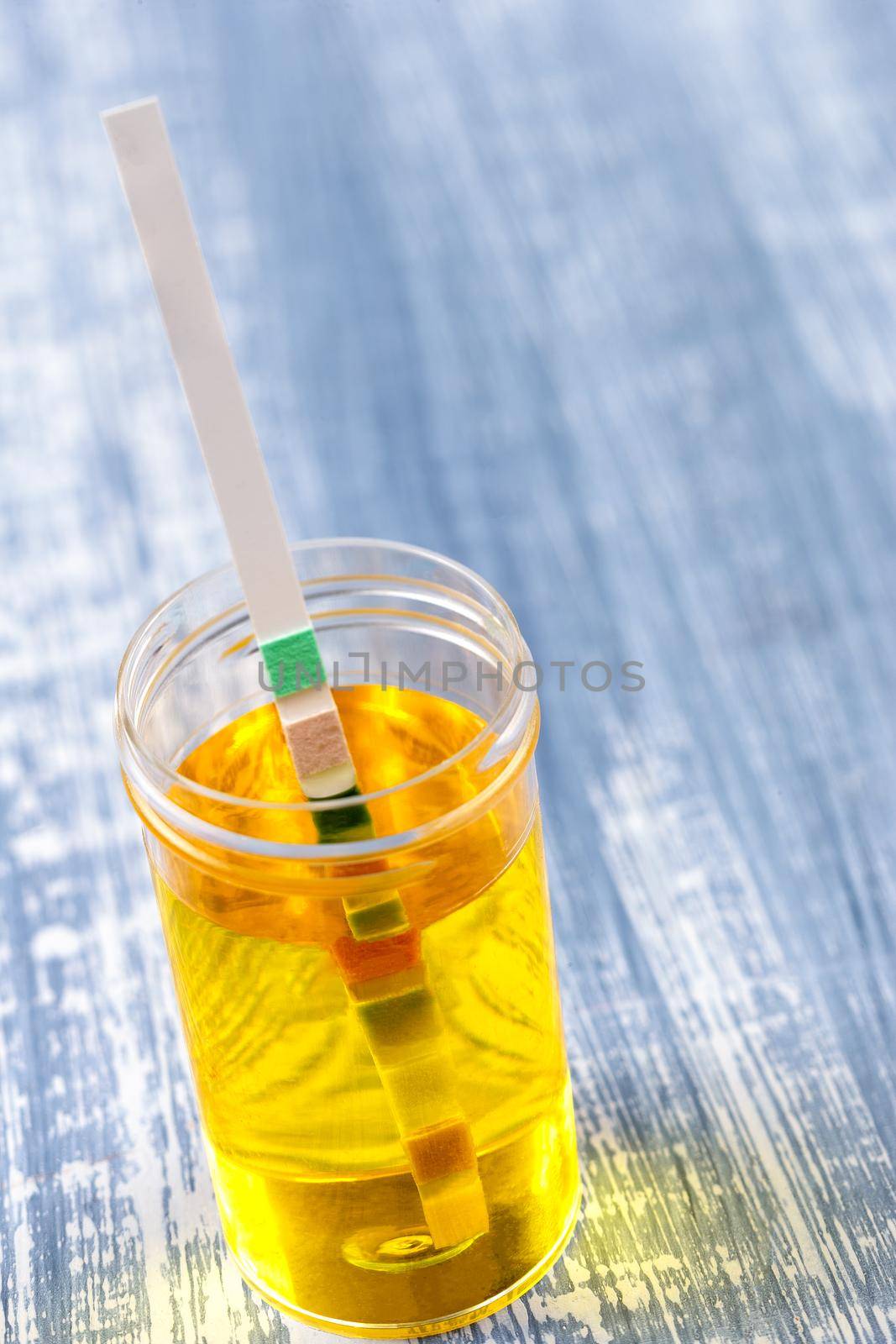 Conceptual image on urin alysis, dipstick placed on the vials of urine by JPC-PROD
