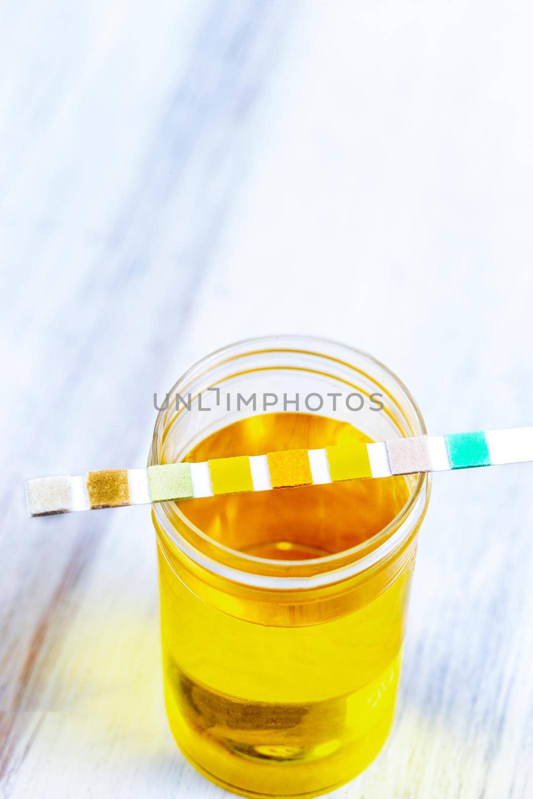 Conceptual image on urin alysis, dipstick placed on the vials of urine by JPC-PROD