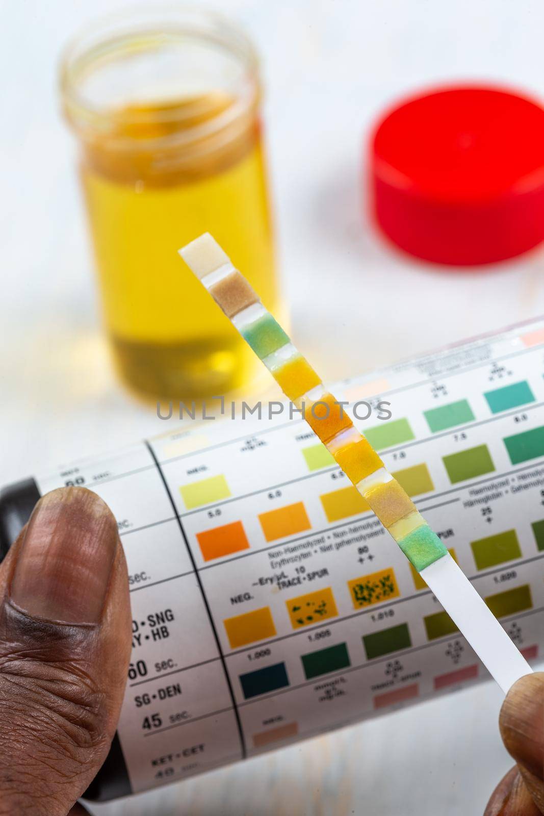 Urine Self-Tests-Self-Measurement close up view by JPC-PROD