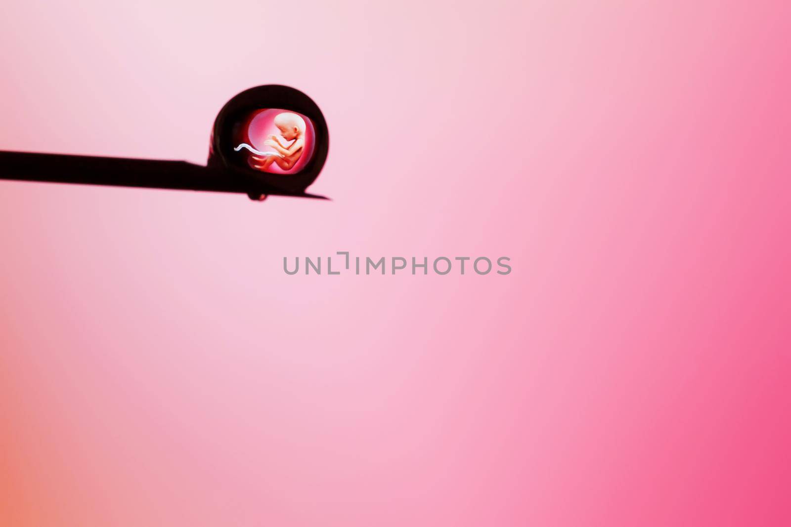 Human embryo in a drop on the tip of a needle on a pink background. Artificial insemination. Test tube baby, IVF. illustrative editorial