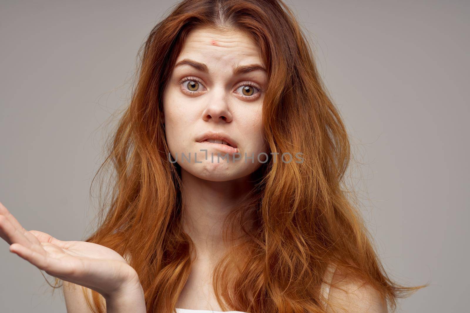 beautiful woman in a white t-shirt pimples on the face close-up. High quality photo