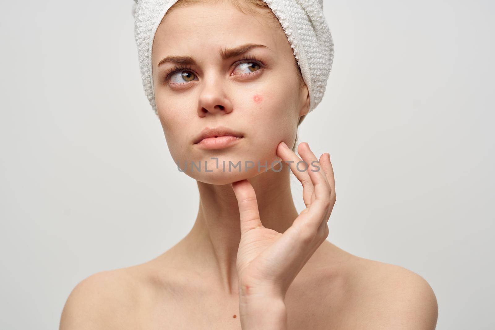 pretty woman with a towel on my head dermatology isolated background by SHOTPRIME