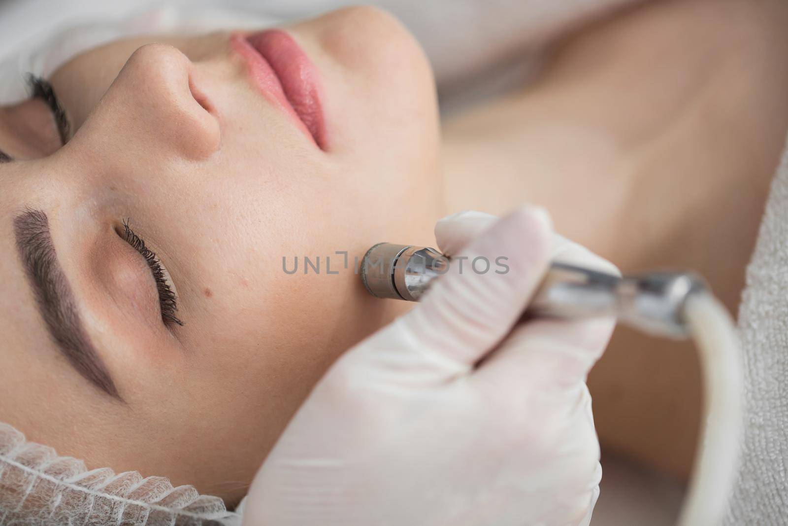 Diamond microdermabrasion, peeling cosmetic. woman during a microdermabrasion treatment in beauty salon. by StudioPeace