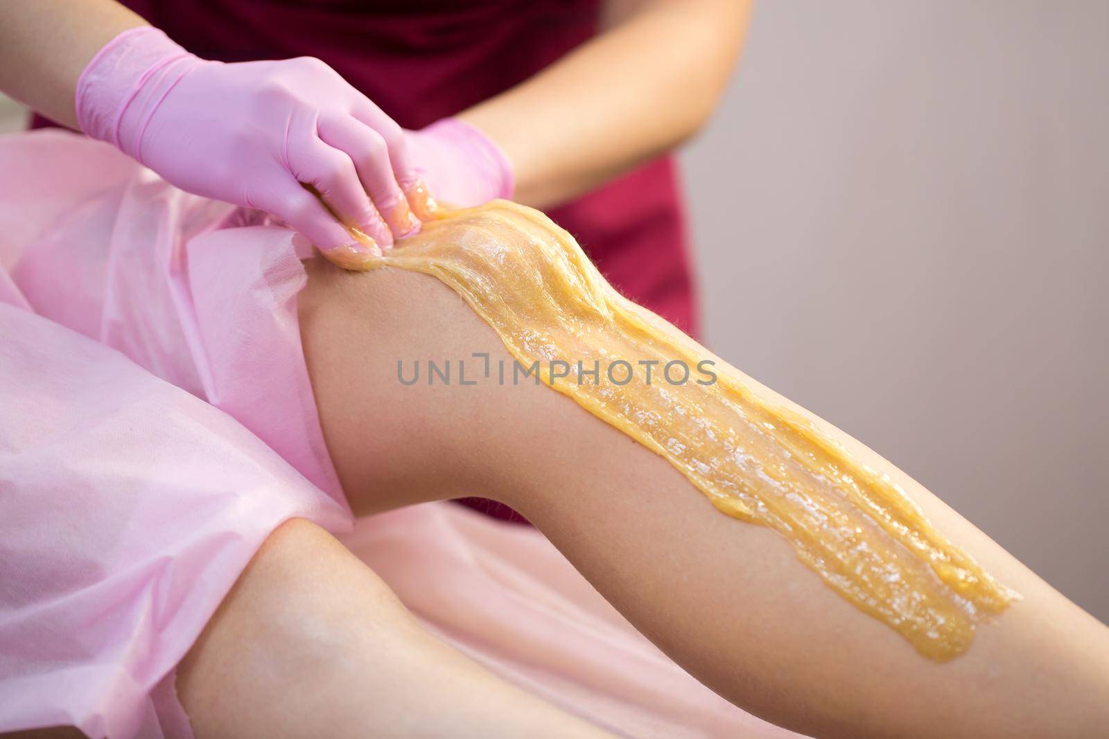 Sugar depilation of the feet in the beauty salon. Rid of hair on the legs. Sugaring. Master shugaring applies thick sugar paste on the legs of a young girl, removing hair on the legs. Close-up.
