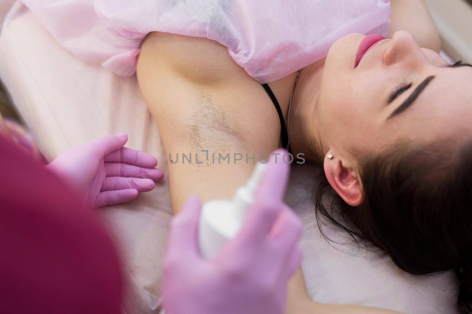 Close-up of armpit of a young girl with hair, hair removal procedure in a beauty salon. Beautician makes shugaring underarms for a young woman. Depilation of armpit with sugar paste