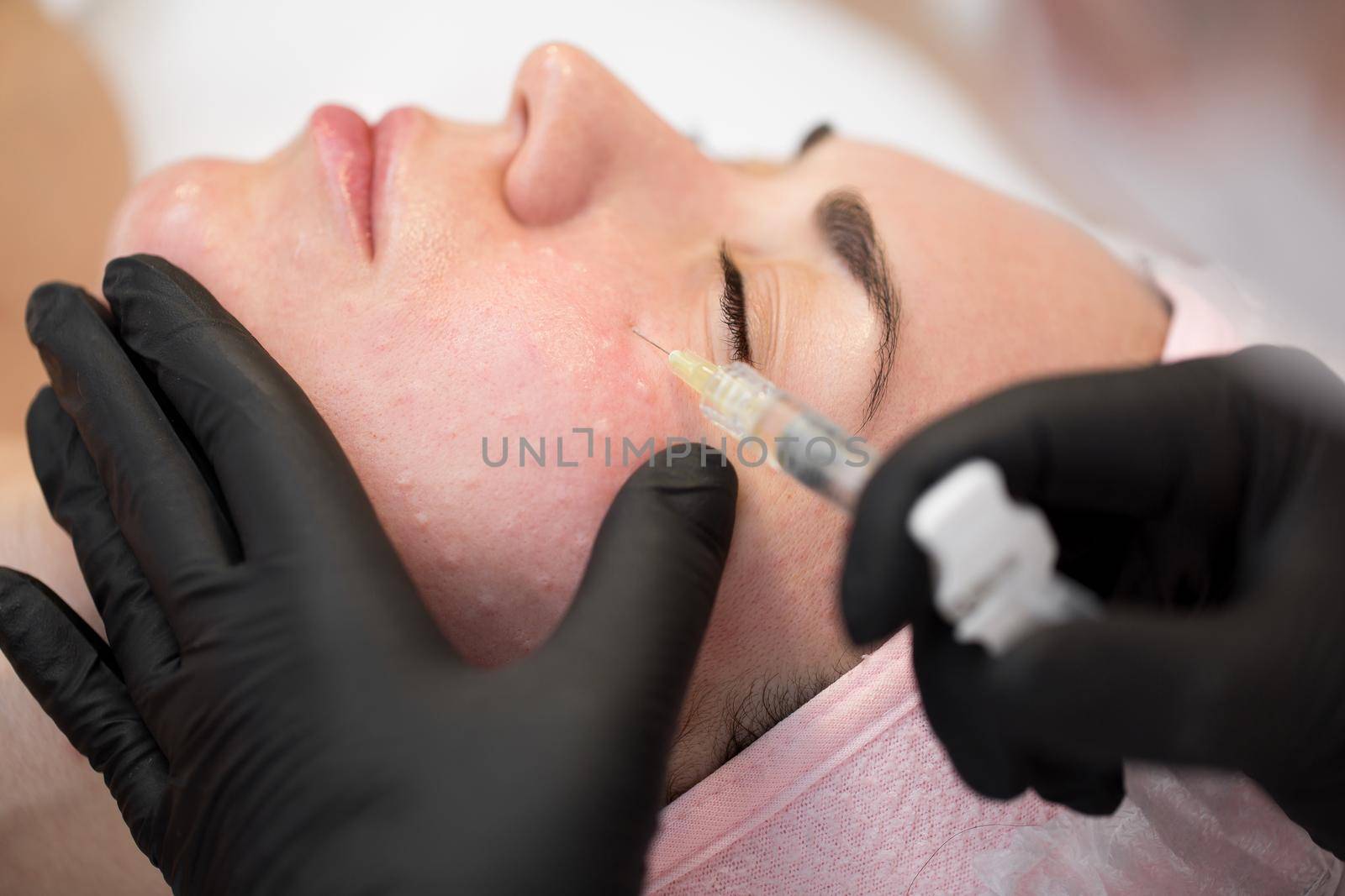 Close-up of cosmetologist makes the Rejuvenating facial injections procedure for tightening on the face skin of woman in a beauty clinic. Biorevitalization procedure.