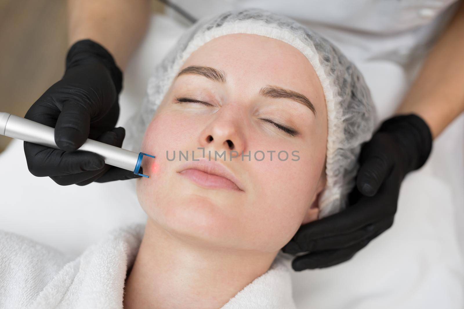 Therapist beautician makes a laser treatment to young woman's face at beauty SPA clinic. Close-up process of laser removal of blood vessels from the skin