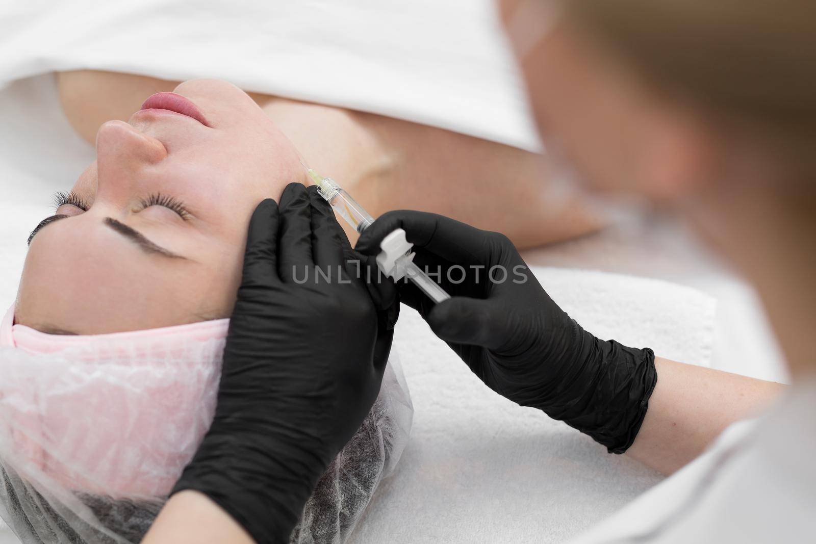 Closeup of cosmetologist doctor making anti-aging injections of a young girl. The beautician does the biorevitalization procedure on the face, blood from injections is visible on the skin by StudioPeace