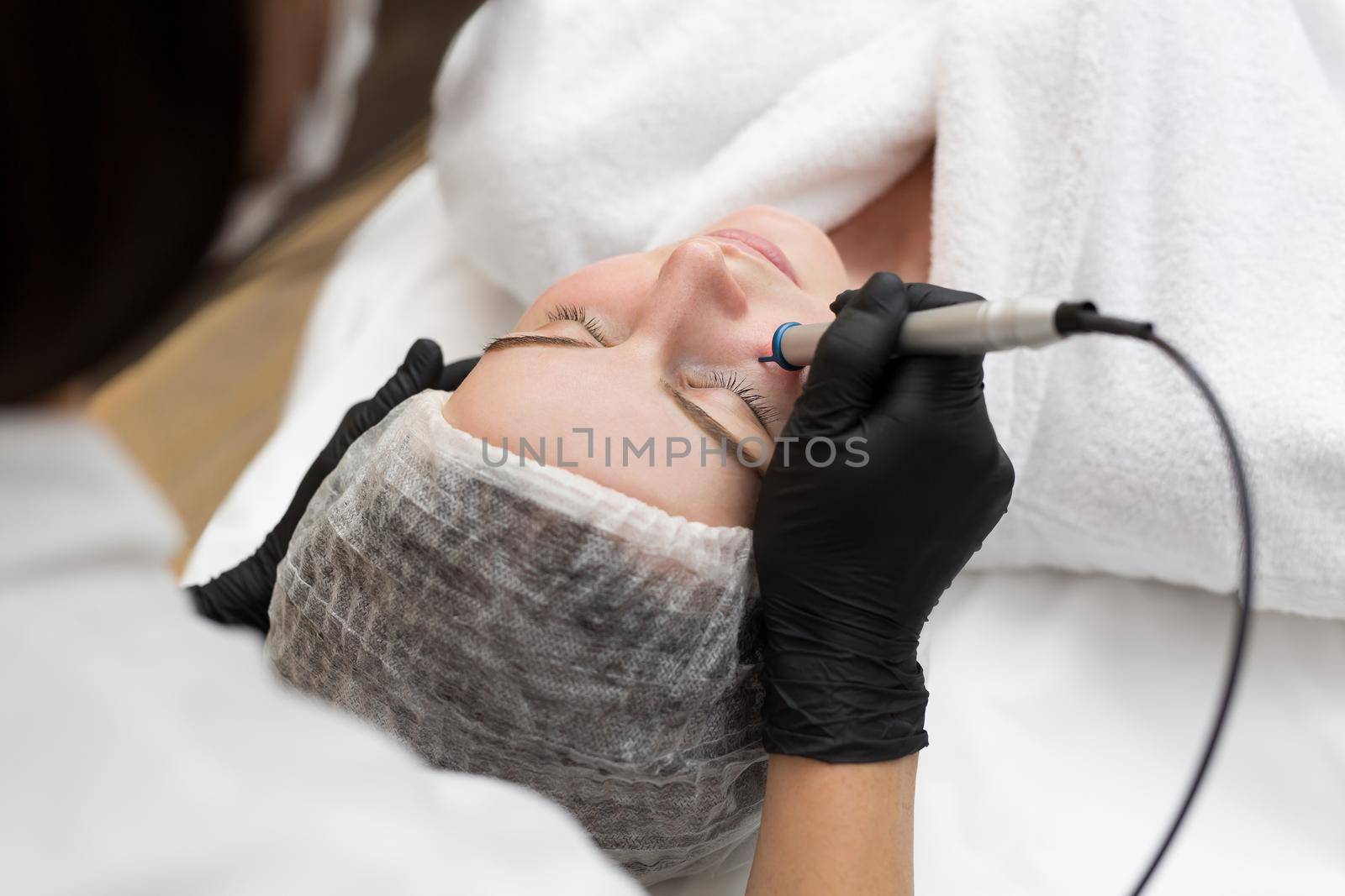 Therapist beautician makes a laser treatment to young woman's face at beauty SPA clinic. Close-up process of laser removal of blood vessels from the skin